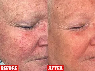 More Than Just a Rash: The Profound Impact of Underestimated Skin Conditions