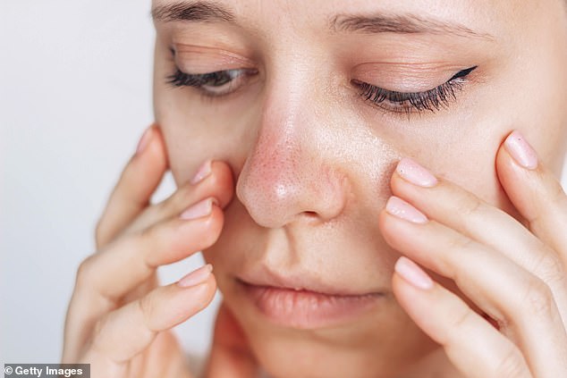 Mystery of the Frozen Nose: A Rare Raynaud's Case Defies Norms