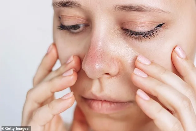 Mystery of the Frozen Nose: A Rare Raynaud's Case Defies Norms