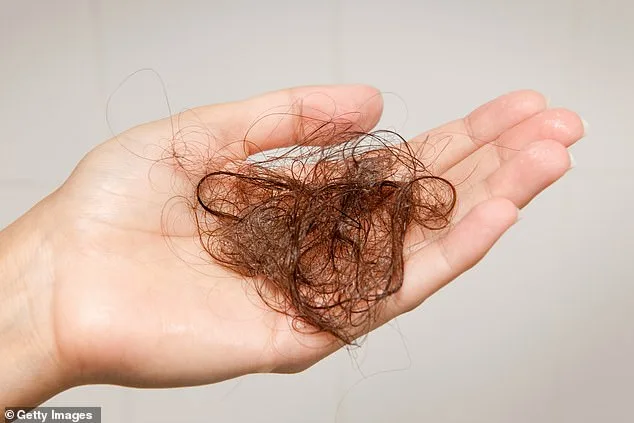 Social Media Creator's Hair Loss Crisis: Confidence Shattered, Hair Fibers Become Lifeline