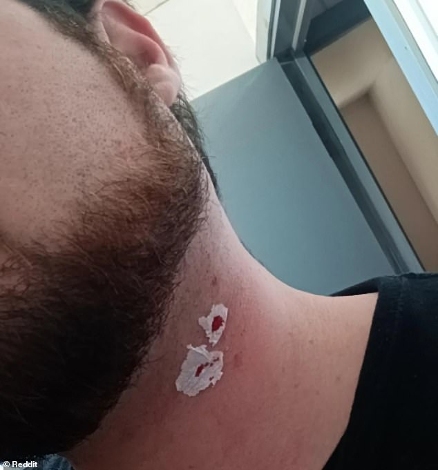 The Rise of Gentler Shaving Tools and the Hidden Skin Risks They Pose