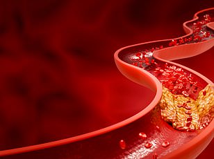 Study Finds 11 Extra Minutes of Sleep Daily Could Cut Heart Attack Risk by 10%