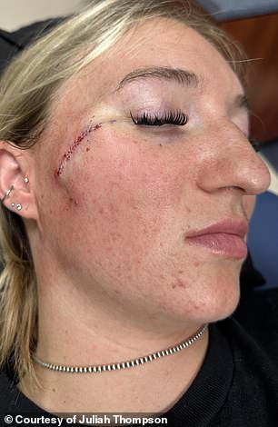 From Harmless Freckle to Life-Threatening Melanoma: The Story of Juliah Thompson's Missed Warning Signs