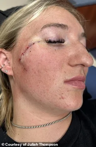 From Harmless Freckle to Life-Threatening Melanoma: The Story of Juliah Thompson's Missed Warning Signs