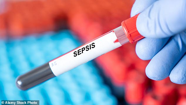 Post-Surgery Sepsis Horror: Mother's Agony Exposes Critical Gaps in UK Medical Care, as 50,000 Lives Lost Annually