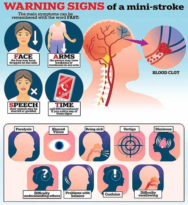 Mini Strokes: The Hidden Warning Sign That Could Save Your Life