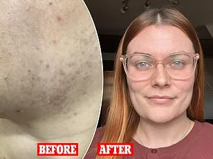 Metformin May Replicate Exercise Benefits, Offering Health Gains Without Workout