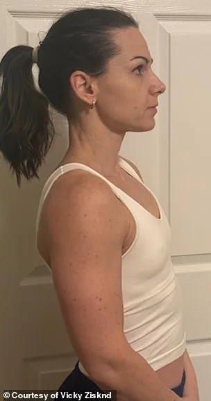 Revolutionary Minimally Invasive Technique Redefines Breast Augmentation