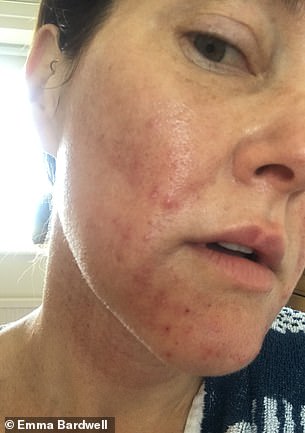 Dulwich Nutritionist Overcomes Perimenopause Crisis to Reclaim Identity and Health