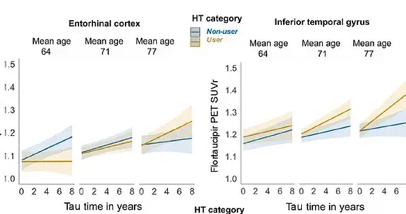 Study Reveals Higher Alzheimer's Risk for Older Women Using Hormone Replacement Therapy