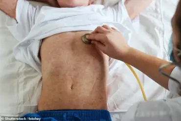 Two Deaths from Measles in West Texas as Outbreak Continues