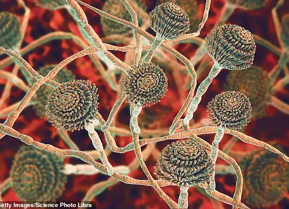 UK GPs Overlook Symptoms of Lethal 'Super-Fungus' Spreading from Southeast Asia