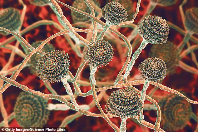 UK GPs Overlook Symptoms of Lethal 'Super-Fungus' Spreading from Southeast Asia