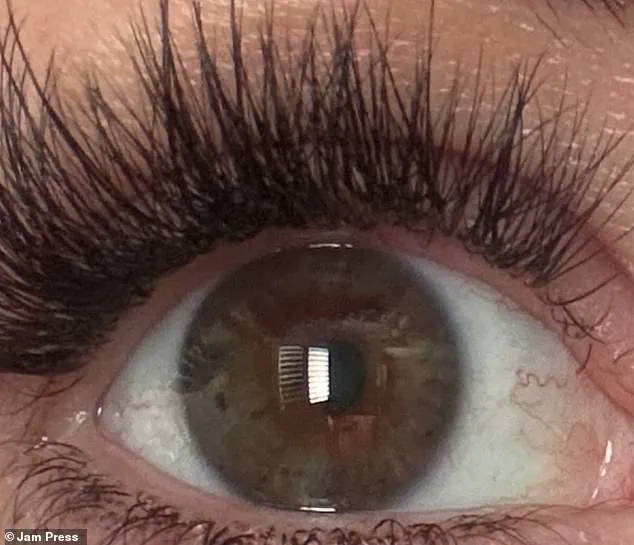 Woman Struck by Lightning Awakens with Different Eye Color