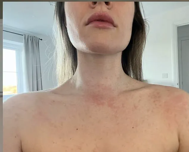 Young Woman's Battle with Aggressive Blood Cancer: A Warning to Dismiss No Symptoms