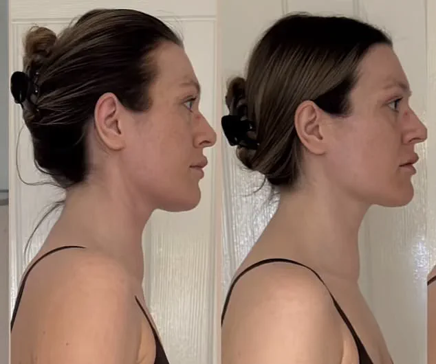 Young Woman's Battle with Aggressive Blood Cancer: A Warning to Dismiss No Symptoms