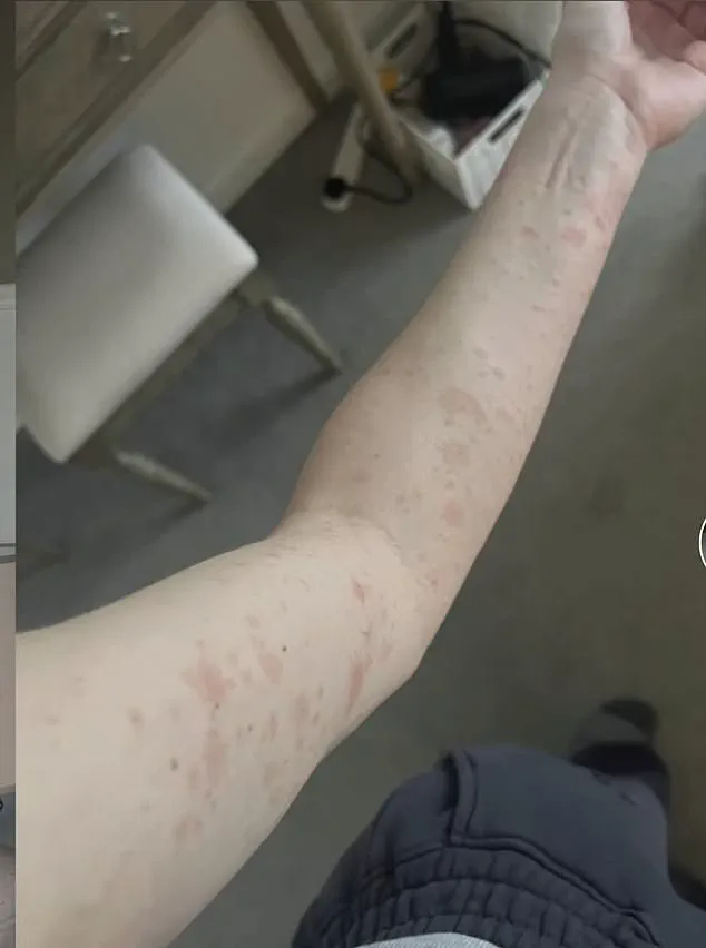 Young Woman's Battle with Aggressive Blood Cancer: A Warning to Dismiss No Symptoms