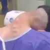 Exclusive: Shocking Images Reveal Dropped Head Syndrome in a 23-Year-Old Drug User, Published by Alzahra Hospital in Iran