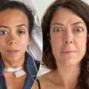 Kallmann Syndrome: A Rare Genetic Disorder Affecting Puberty and Sense of Smell