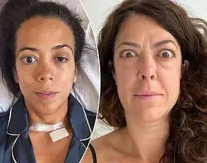 Kallmann Syndrome: A Rare Genetic Disorder Affecting Puberty and Sense of Smell