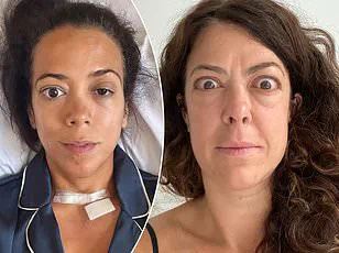 Kallmann Syndrome: A Rare Genetic Disorder Affecting Puberty and Sense of Smell