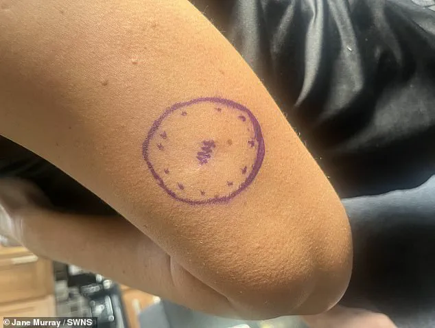 Stark Warning on Natural Tan Dangers as Former Sun Worshipper Diagnosed with Melanoma
