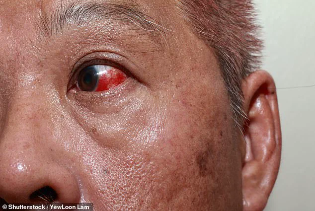 Government Regulations and Public Health: The Critical Role of Ocular Health in Early Disease Detection