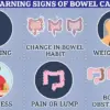 Study Presented at ASCO: 1.5 Hours of Daily Exercise Could Reduce Colon Cancer Mortality by Over a Third