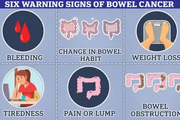 Study Presented at ASCO: 1.5 Hours of Daily Exercise Could Reduce Colon Cancer Mortality by Over a Third