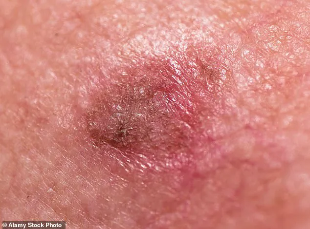 The Human Skin: A Protective Barrier and Regulatory System for Homeostasis