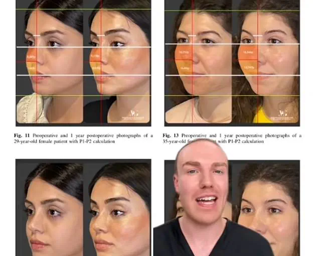 Cosmetic Doctor's Controversial Theory on Emma Stone's Appearance Sparks Viral Debate