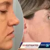 Japanese YouTuber Claims World's Longest Chin, Highlighting Unusual Mandible Growth