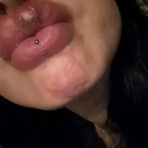 Mother of Three's Harrowing Journey After Cosmetic Treatments at Local Home Salon