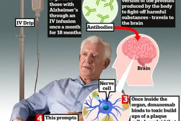 Scientists Describe Trontinemab as 'Very Promising' in Breakthrough Alzheimer's Research