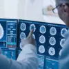 Study Links Gabapentin, Widely Prescribed for Back Pain, to Increased Dementia Risk