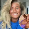 Sunbed Addiction and Its Alarming Health Risks: A Teen's Struggle with Skin Damage and Compulsive Tanning Habits