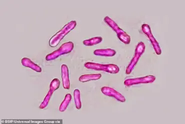 UKHSA Alerts Public to Botulism Risks from Unlicensed Cosmetic Injections, 40 Cases Reported