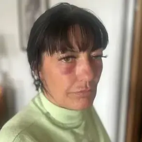 Unlicensed Botox Procedure Sparks Calls for Stricter Cosmetic Regulation After Life-Threatening Incident