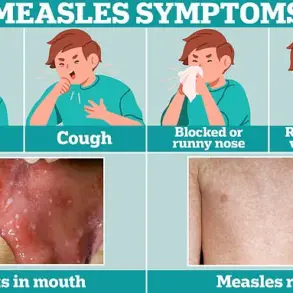 Urgent Warnings Over Measles Resurgence as MMR Vaccination Rates Plunge in UK, Experts Say – Liverpool Tragedy Sparks Calls for Action