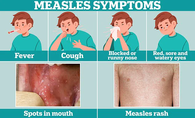 Urgent Warnings Over Measles Resurgence as MMR Vaccination Rates Plunge in UK, Experts Say – Liverpool Tragedy Sparks Calls for Action