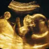 AI Predicts Due Dates with 95% Accuracy, Challenging Naegele’s Rule: 'This Is a Game-Changer for Obstetrics,' Says Lead Researcher