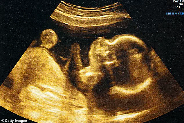AI Predicts Due Dates with 95% Accuracy, Challenging Naegele’s Rule: 'This Is a Game-Changer for Obstetrics,' Says Lead Researcher