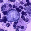 As Global Temperatures Rise, Brain-Eating Amoeba Spreads: Urgent Calls for Environmental Safeguards to Prevent Public Health Crisis