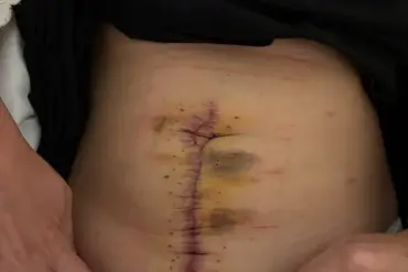 Breaking: Overlooked Symptoms and Fertility Struggles Signal a Growing Health Crisis for Women in Their 30s