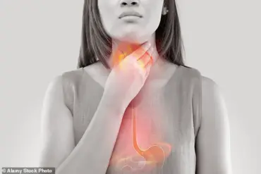 Lynda Hammett: 'Omeprazole Changed My Life—For Better and Worse' as Debate Over Long-Term PPI Use Intensifies