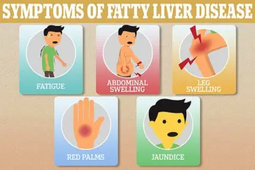 Public Health Alert: Rising Liver Disease Among Professionals Sparks Calls for Regulatory Action and Workplace Health Initiatives