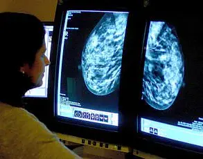 Restricted Access to Groundbreaking Research: Beta Blockers' Dual Role in Blood Pressure and Breast Cancer