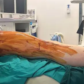 Risky Pursuit of Height: UK Men Undergo Painful, Costly Surgery Abroad