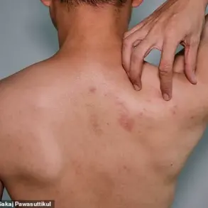 Study Suggests Shingles Vaccine May Reduce Heart Attack and Stroke Risk by 20%, Prompting Review of Current Guidelines