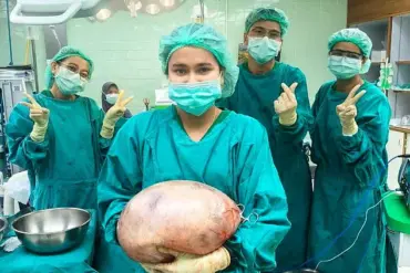 Unexpected Discovery: Thai Woman's 'Fat Belly' Found to Be a 17-Pound Ovarian Cyst
